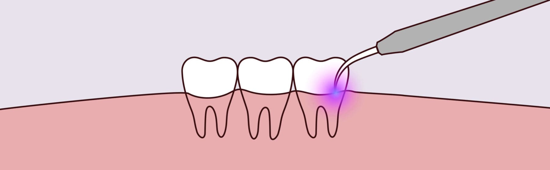 - Bloō Dental