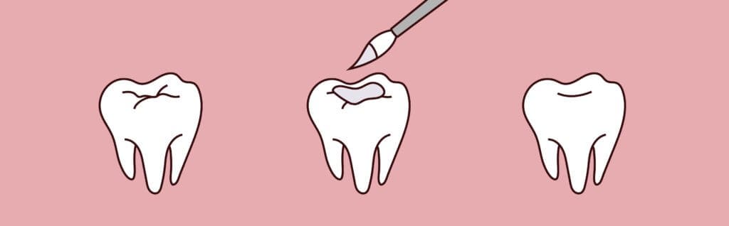 Bloō Dental -