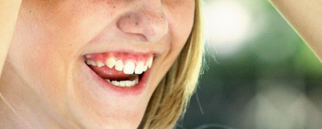 Bloō Dental -