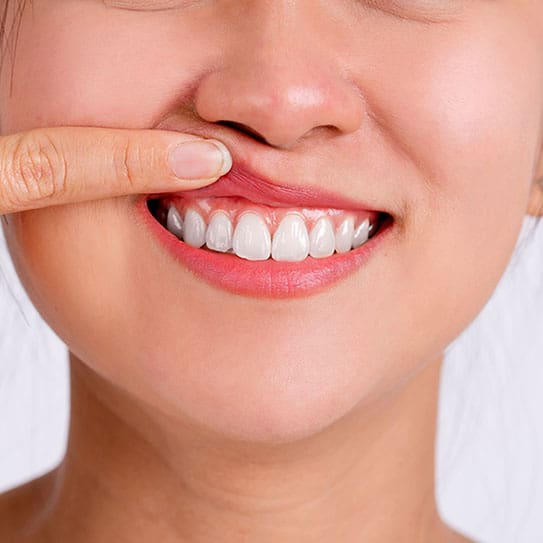 Bloō Dental -