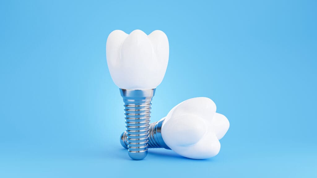 implants near me