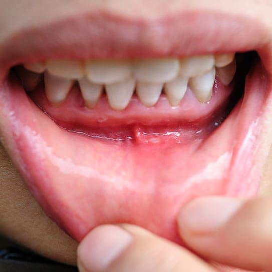 - Bloō Dental